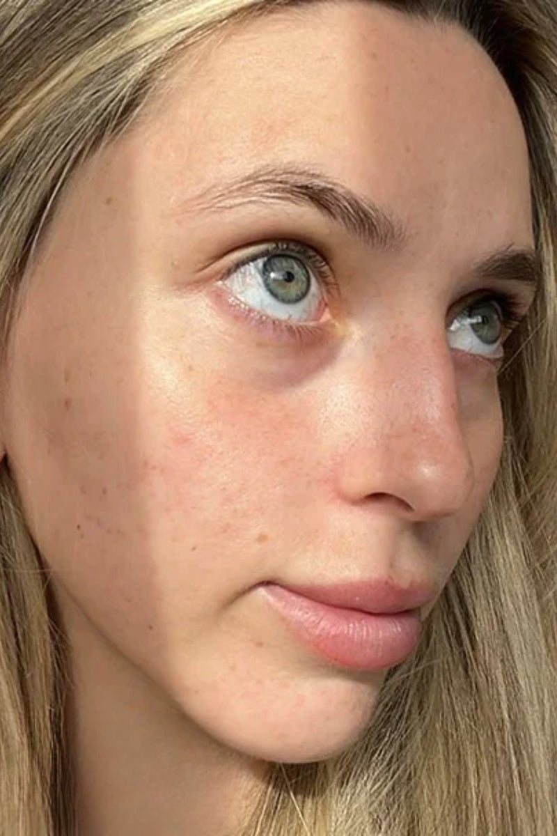 After using product