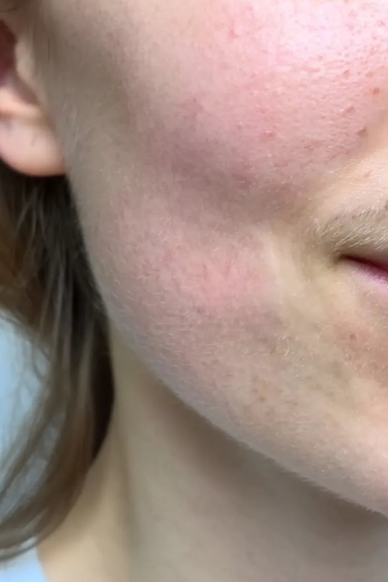 After using product