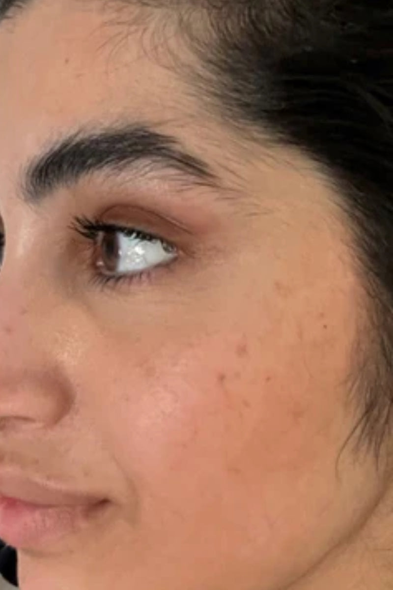After using product