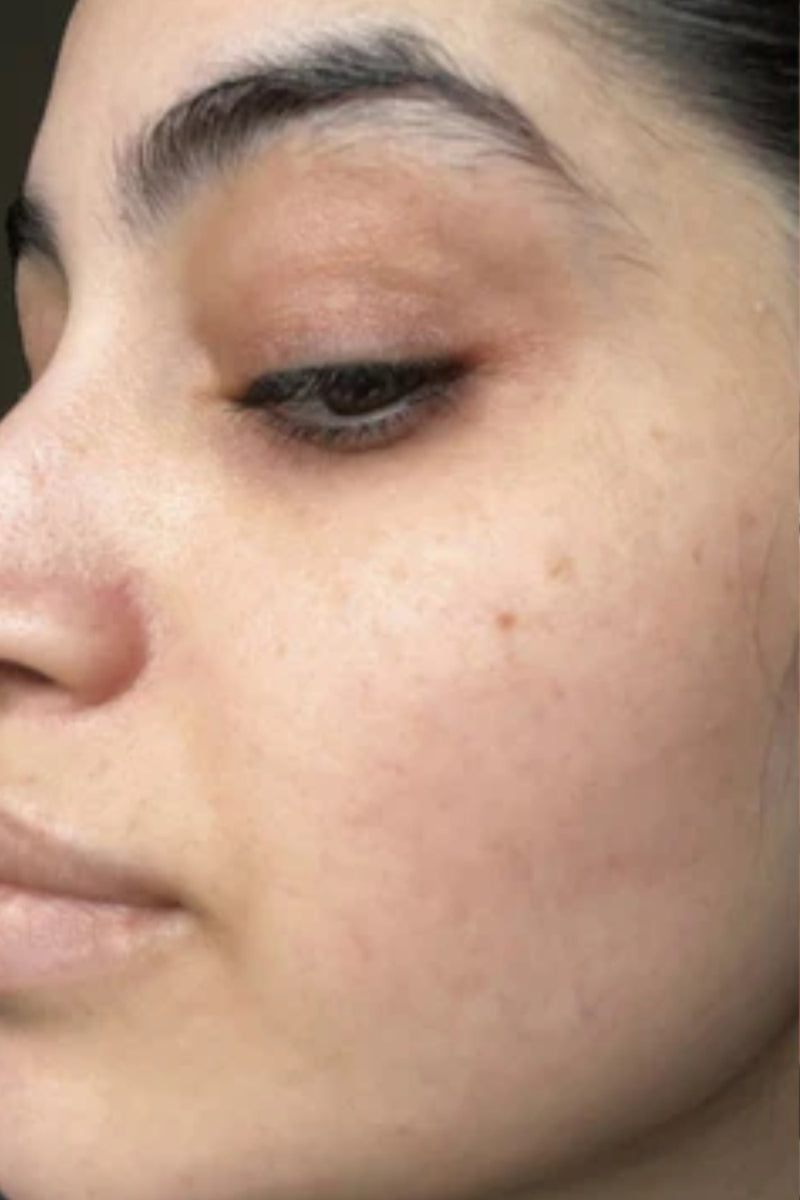 Before using product