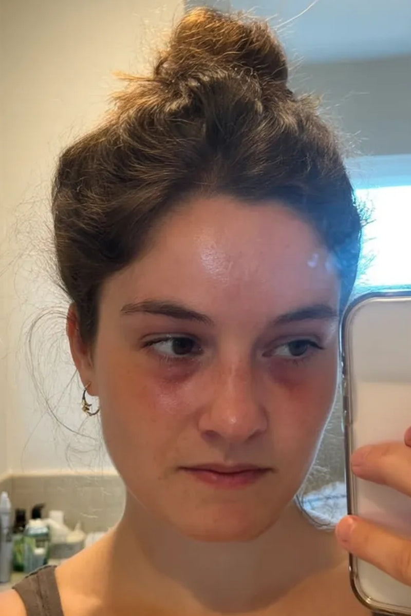 Before using product