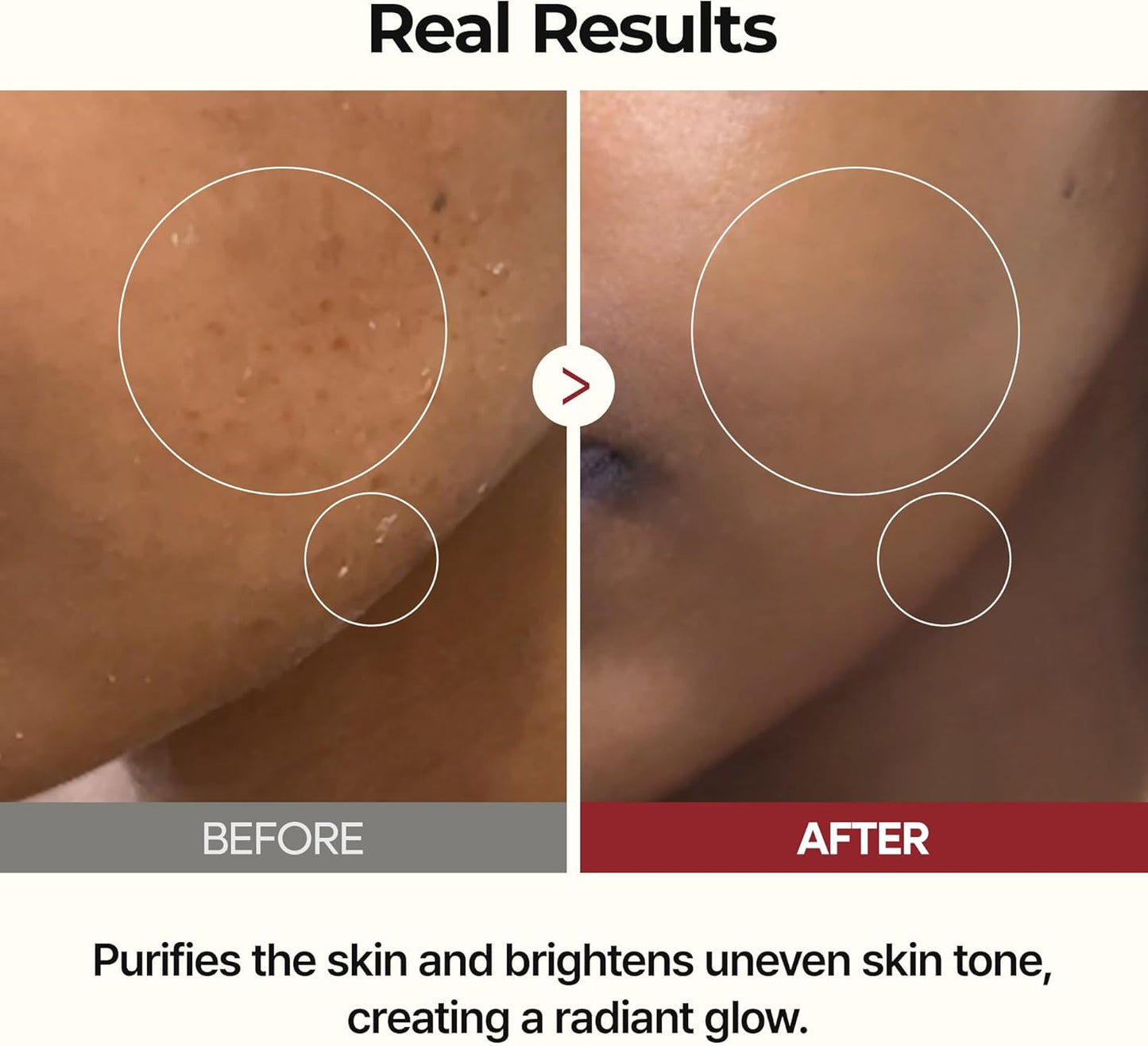 Peel Shot Glow Rice Line