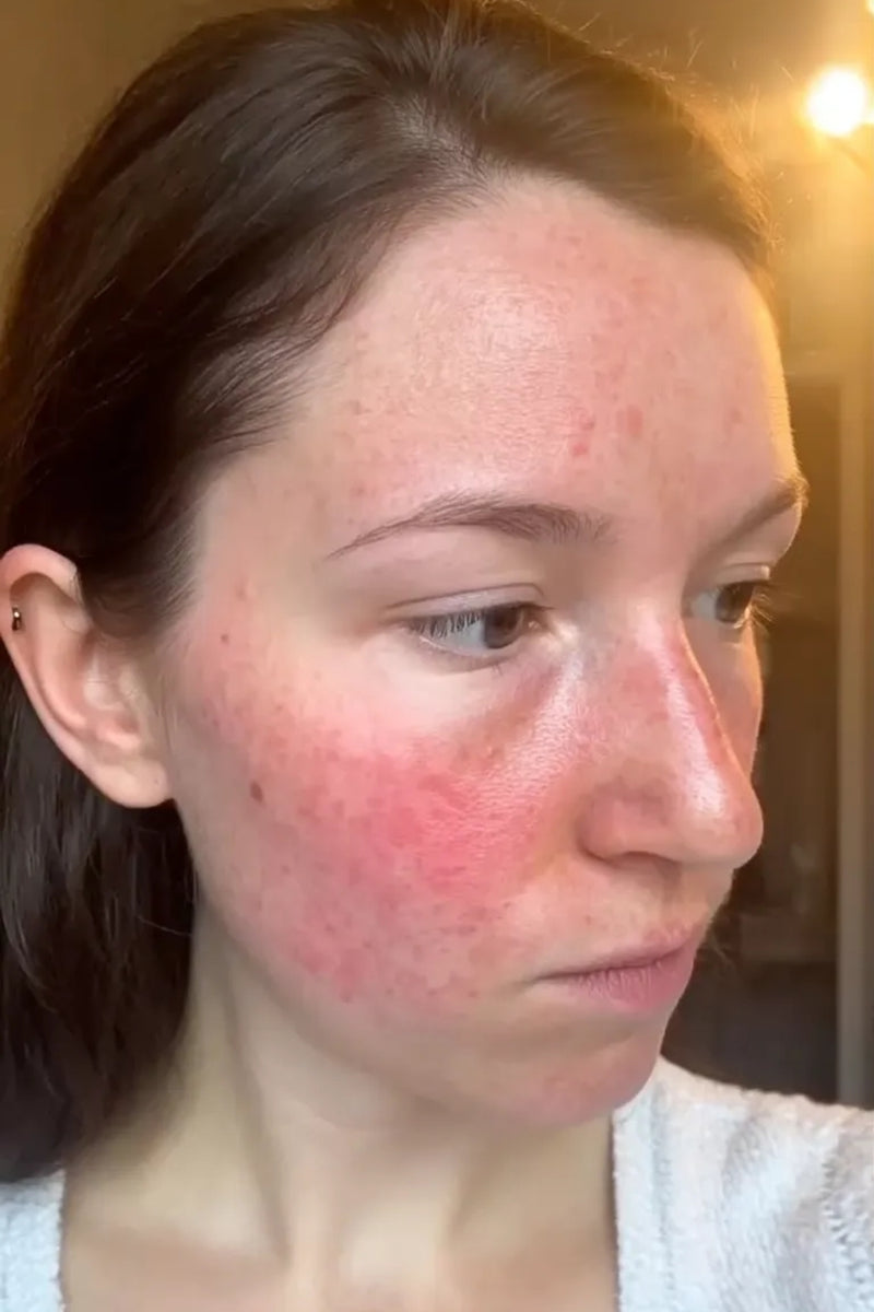Before using product