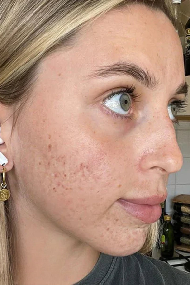 Before using product