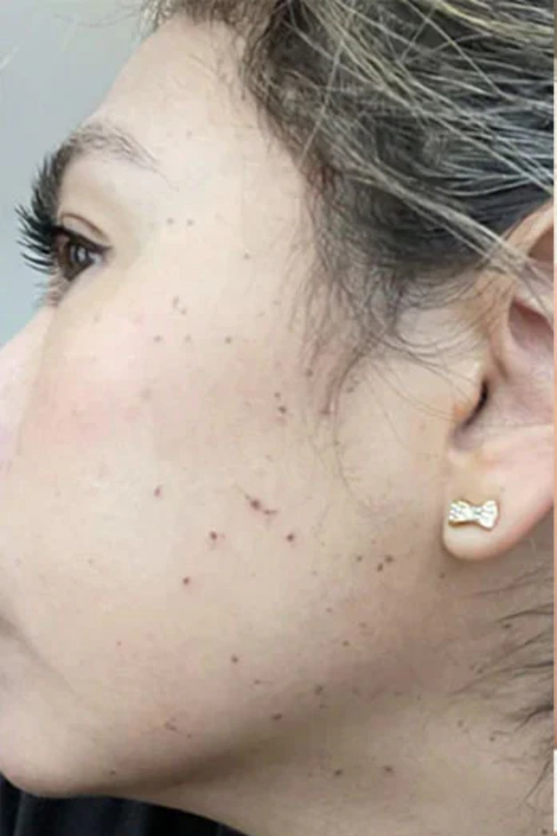 Before using product