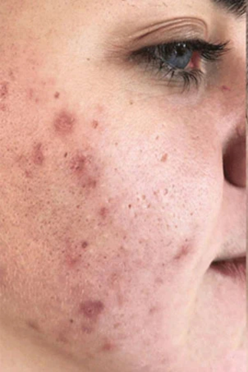 Before using product