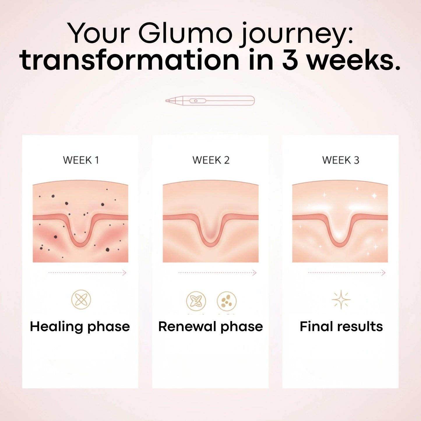 Glumo™ Plasma Pen