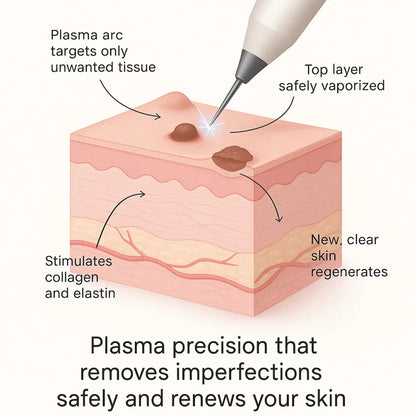 Glumo™ Plasma Pen