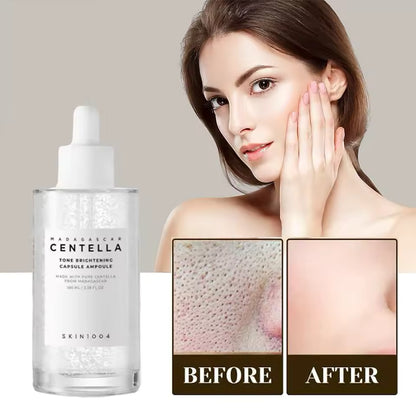 Centella Asiatica Ampoule Essence (100ml/3.38 fl oz)